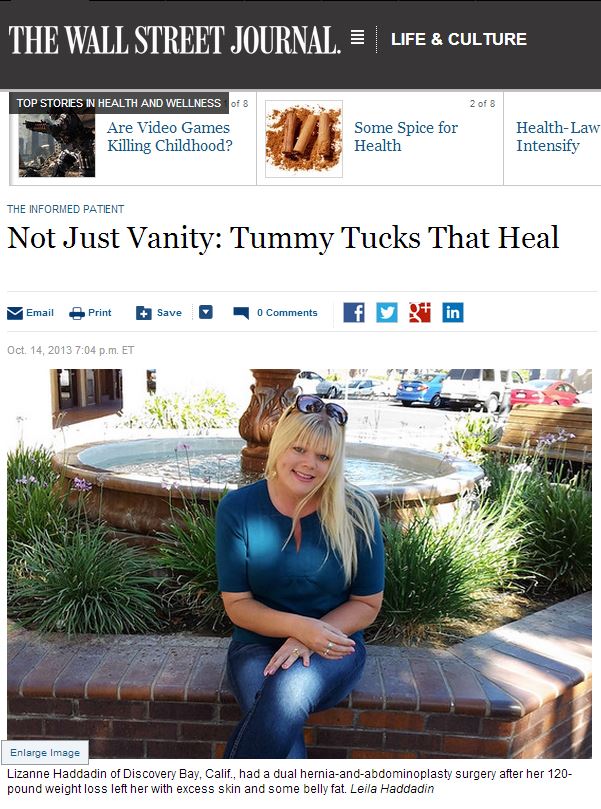 tummy tuck houston tx tummy tuck houston tx
