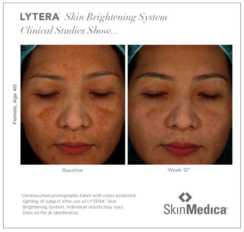 SkinMedica® in Plano, TX